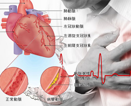 心臟病患者在醫生指引下能服用威而鋼
