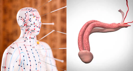 中醫觀點中的陽痿 中醫觀點中的陽痿